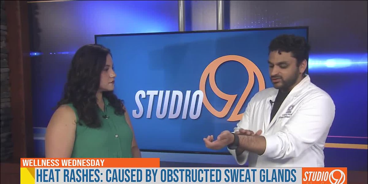 Wellness Wednesday: Doctor shares tips for treating heat rashes, poison ivy this summer
